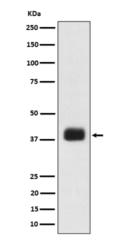 SR protein repeat Rabbit Monoclonal Antibody - Size: 100µl