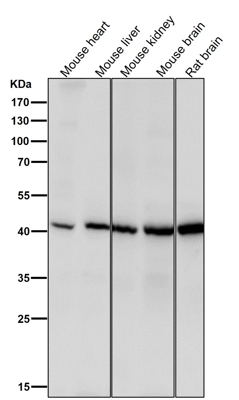 Spermine synthase Rabbit Monoclonal Antibody - Size: 100µl