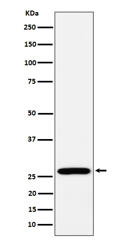 RPL13 Rabbit Monoclonal Antibody - Size: 50µl