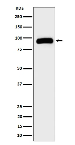 TRPV5 Rabbit Monoclonal Antibody - Size: 100µl