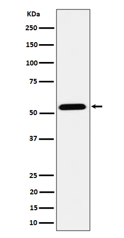 ENPP5 Rabbit Monoclonal Antibody - Size: 50µl