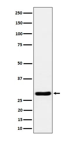 WesternBlot(WB) - Calcipressin 1 Rabbit Monoclonal Antibody AMRe84733