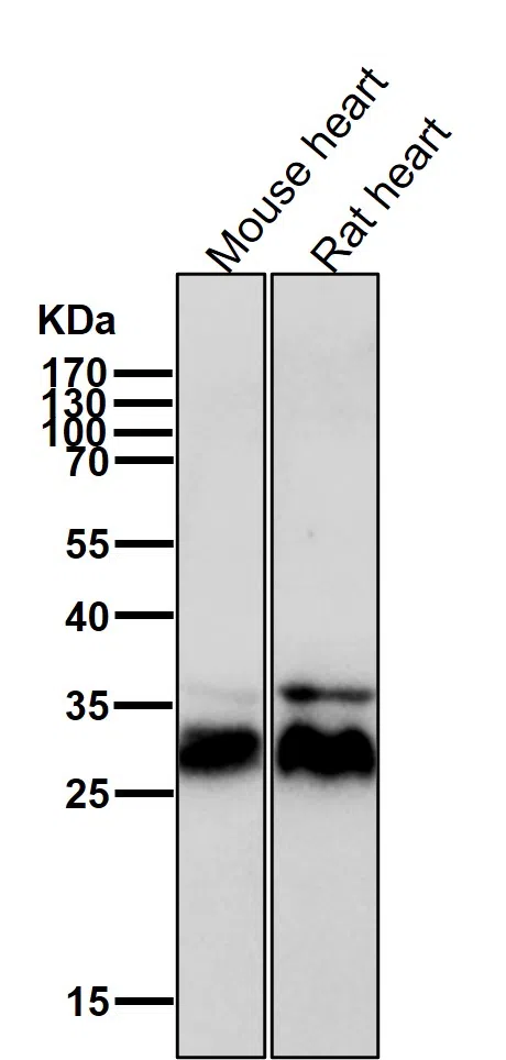 WesternBlot(WB) - Calcipressin 1 Rabbit Monoclonal Antibody AMRe84733