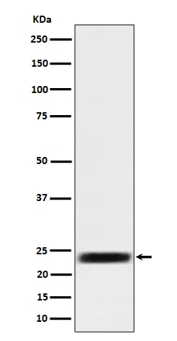 ARFRP1/ARP Rabbit Monoclonal Antibody - Size: 100µl