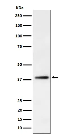 FDPS Rabbit Monoclonal Antibody