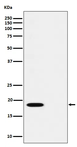 Phospho-PTS(S19) Rabbit Monoclonal Antibody - Size: 50µl