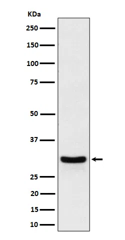 FRAT1 Rabbit Monoclonal Antibody - Size: 100µl