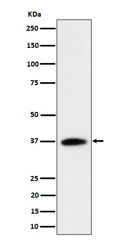 RASSF2 Rabbit Monoclonal Antibody - Size: 50µl