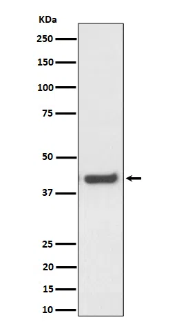 MVK Rabbit Monoclonal Antibody - Size: 100µl