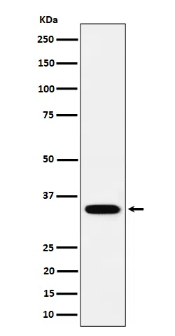 PPCS Rabbit Monoclonal Antibody - Size: 50µl