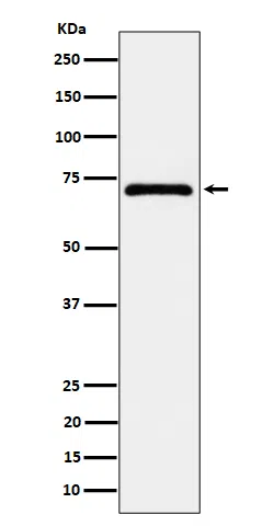 EPHX2 Rabbit Monoclonal Antibody - Size: 50µl