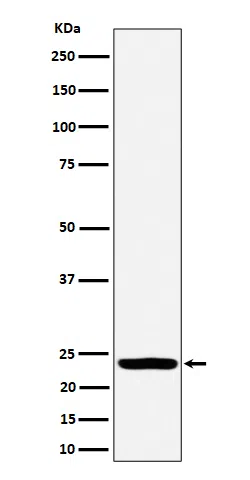 DTYMK Rabbit Monoclonal Antibody - Size: 50µl
