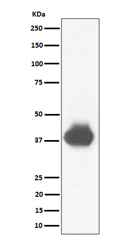 CD32A+CD32B+CD32C Rabbit Monoclonal Antibody - Size: 50µl
