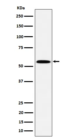 PNK/PNKP Rabbit Monoclonal Antibody - Size: 50µl