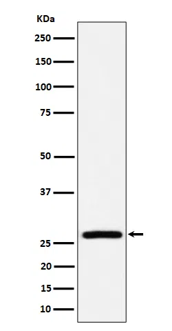 AK2 Rabbit Monoclonal Antibody - Size: 100µl