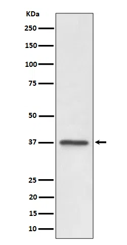 C3orf38 Rabbit Monoclonal Antibody - Size: 50µl