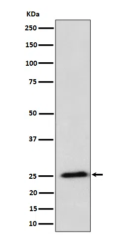 RPL10A Rabbit Monoclonal Antibody - Size: 50µl