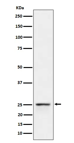 PEX11B Rabbit Monoclonal Antibody