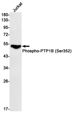 Phospho-PTP1B (Ser352) Rabbit Monoclonal Antibody - Size: 100µl