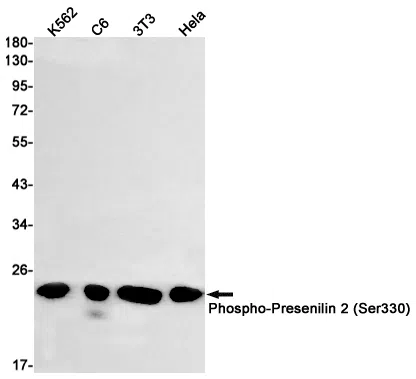 Phospho-Presenilin 2 (Ser330) Rabbit Monoclonal Antibody - Size: 50µl