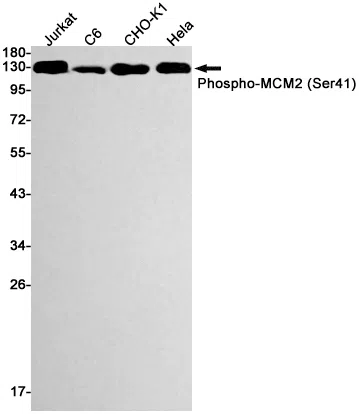 Phospho-MCM2 (Ser41) Rabbit Monoclonal Antibody - Size: 100µl