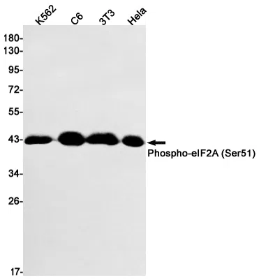 Phospho-eIF2A (Ser51) Rabbit Monoclonal Antibody