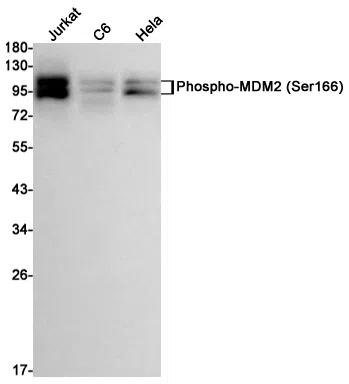 Phospho-MDM2 (Ser166) Rabbit Monoclonal Antibody - Size: 100µl