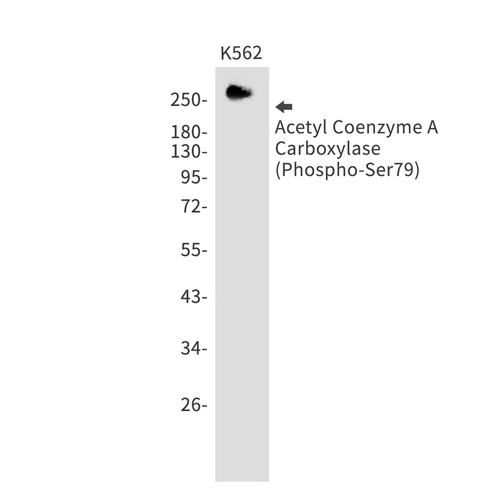 Phospho-Acetyl-Coenzyme A Carboxylase (Ser79) Rabbit Monoclonal Antibody
