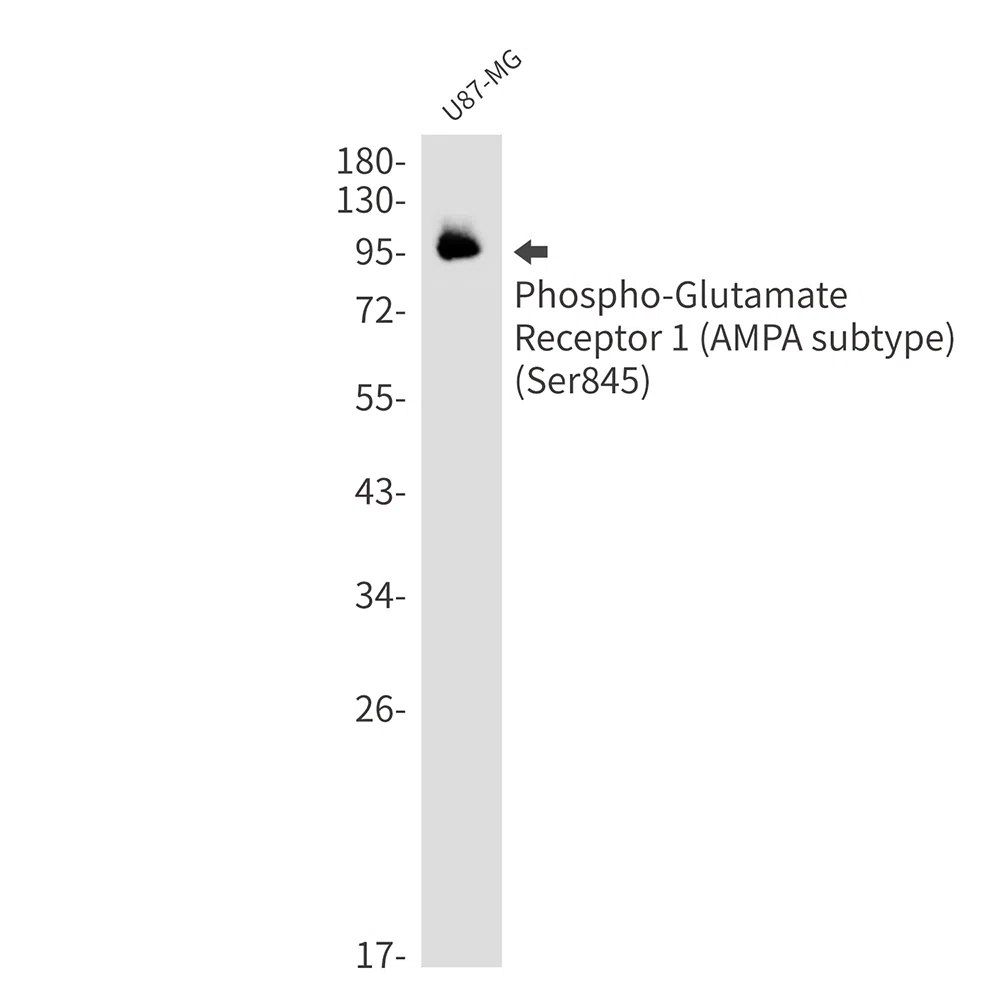 Phospho-Glutamate Receptor 1 (AMPA Subtype) (Ser845) Rabbit Monoclonal A