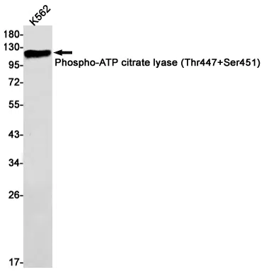 Phospho-ATP Citrate Synthase (Thr447/Ser451) Rabbit Monoclonal Antibody