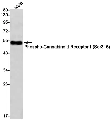 Phospho-Cannabinoid Receptor I (Ser316) Rabbit Monoclonal Antibody - Siz