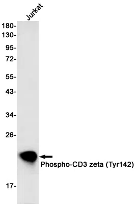 Phospho-CD3 zeta (Tyr142) Rabbit Monoclonal Antibody - Size: 50µl
