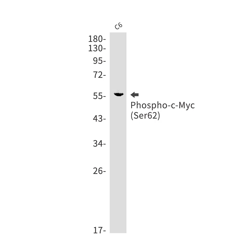 Phospho-c-Myc (Ser62) Rabbit Monoclonal Antibody - Size: 100µl