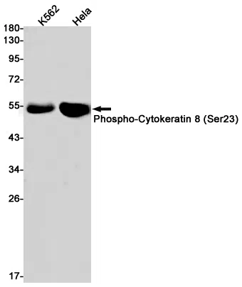 Phospho-Cytokeratin 8 (Ser23) Rabbit Monoclonal Antibody - Size: 100µl