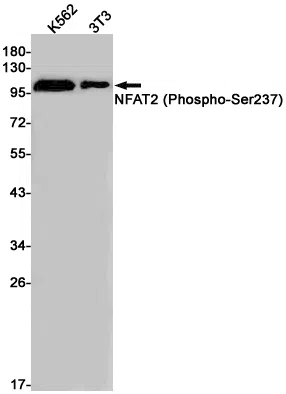 Phospho-NFAT2 (Ser237) Rabbit Monoclonal Antibody - Size: 100µl