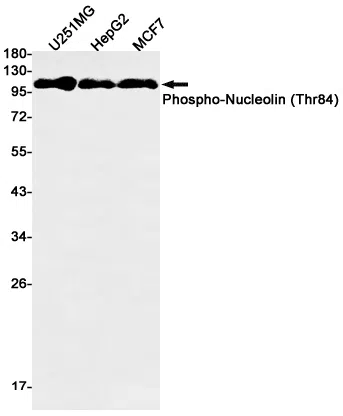 Phospho-Nucleolin (Thr84) Rabbit Monoclonal Antibody - Size: 50µl