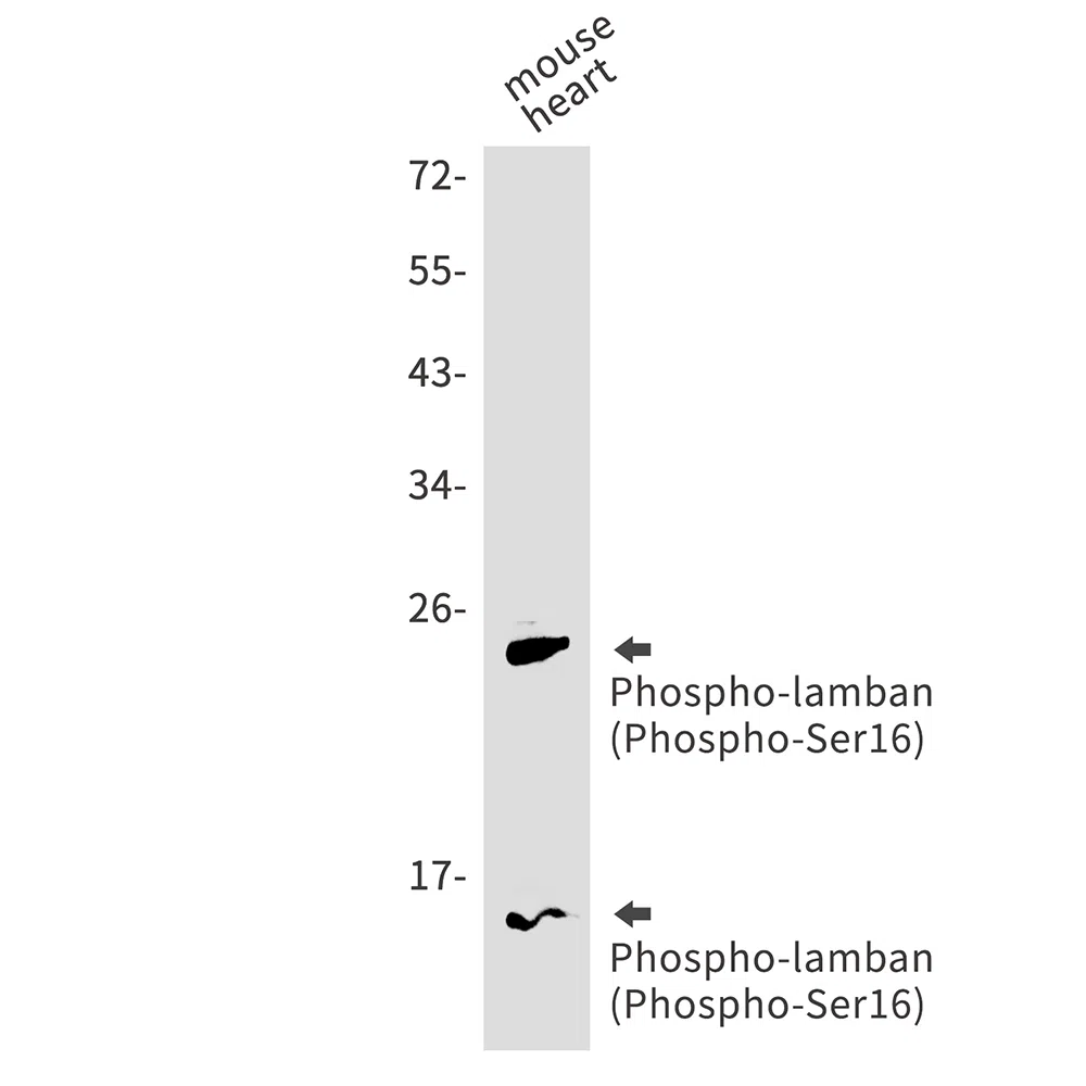 Phospho-Phospholamban (Ser16) Rabbit Monoclonal Antibody - Size: 100µl