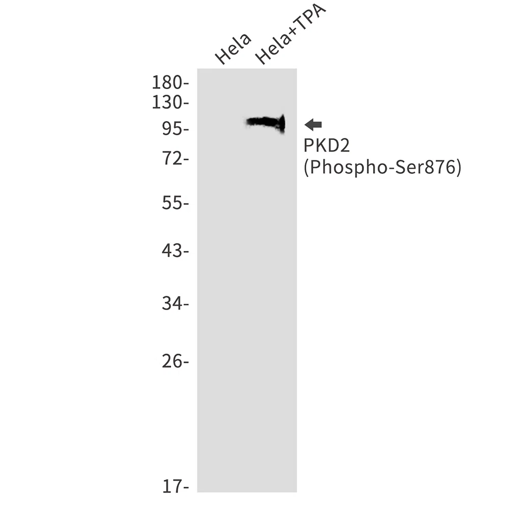 Phospho-PRKD2 (Ser876) Rabbit Monoclonal Antibody - Size: 100µl