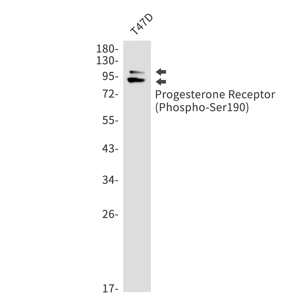 Phospho-Progesterone Receptor (Ser190) Rabbit Monoclonal Antibody - Size
