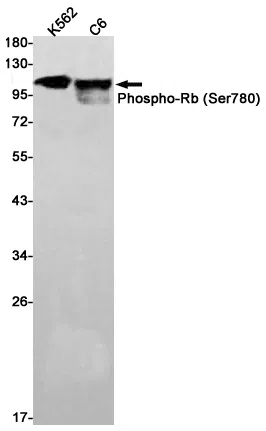 Phospho-Rb (Ser780) Rabbit Monoclonal Antibody - Size: 100µl