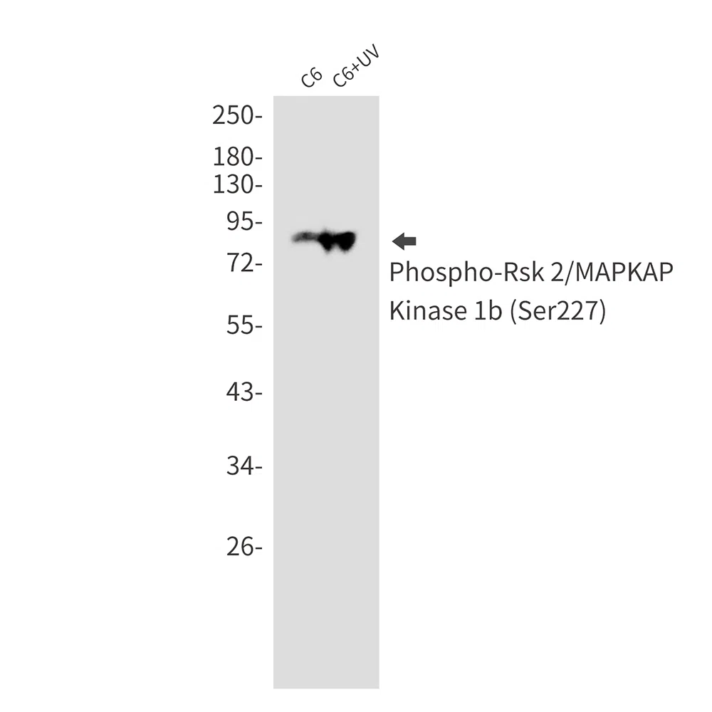 Phospho-RSK2 (Ser227) Rabbit Monoclonal Antibody - Size: 50µl