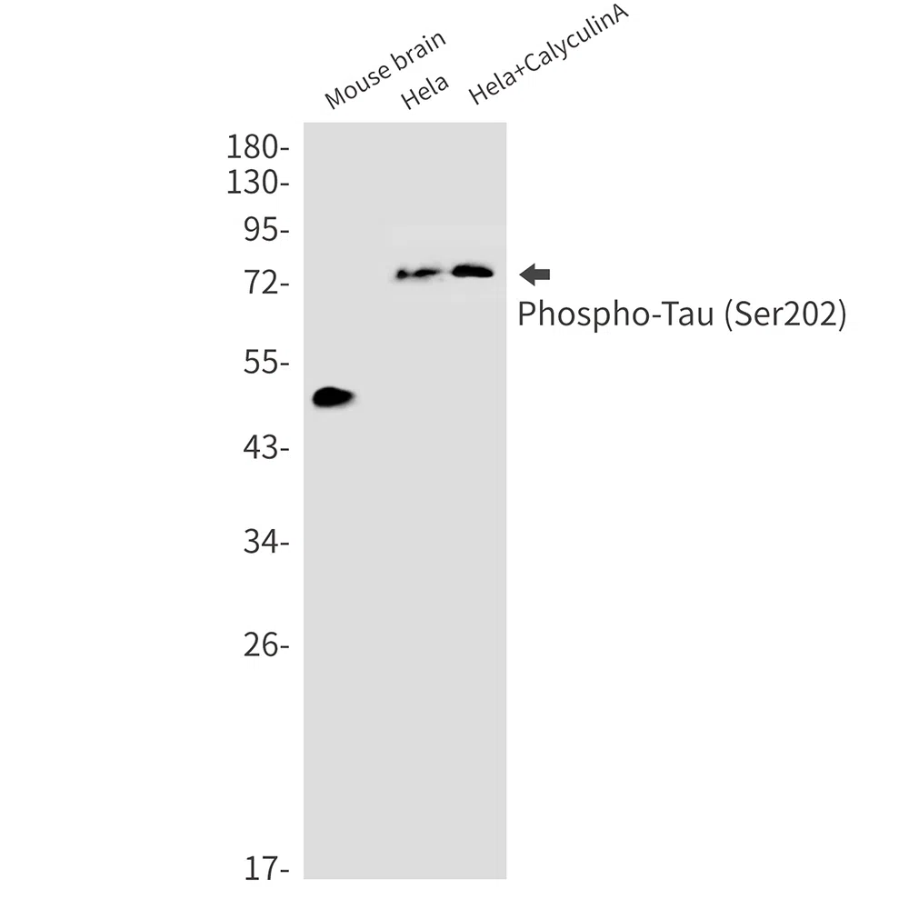 Phospho-Tau (Ser202) Rabbit Monoclonal Antibody - Size: 100µl