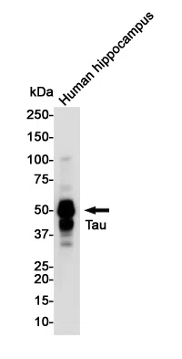 Phospho-Tau (Thr50) Rabbit Monoclonal Antibody - Size: 100µl