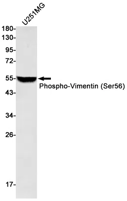 Phospho-Vimentin (Ser56) Rabbit Monoclonal Antibody - Size: 50µl