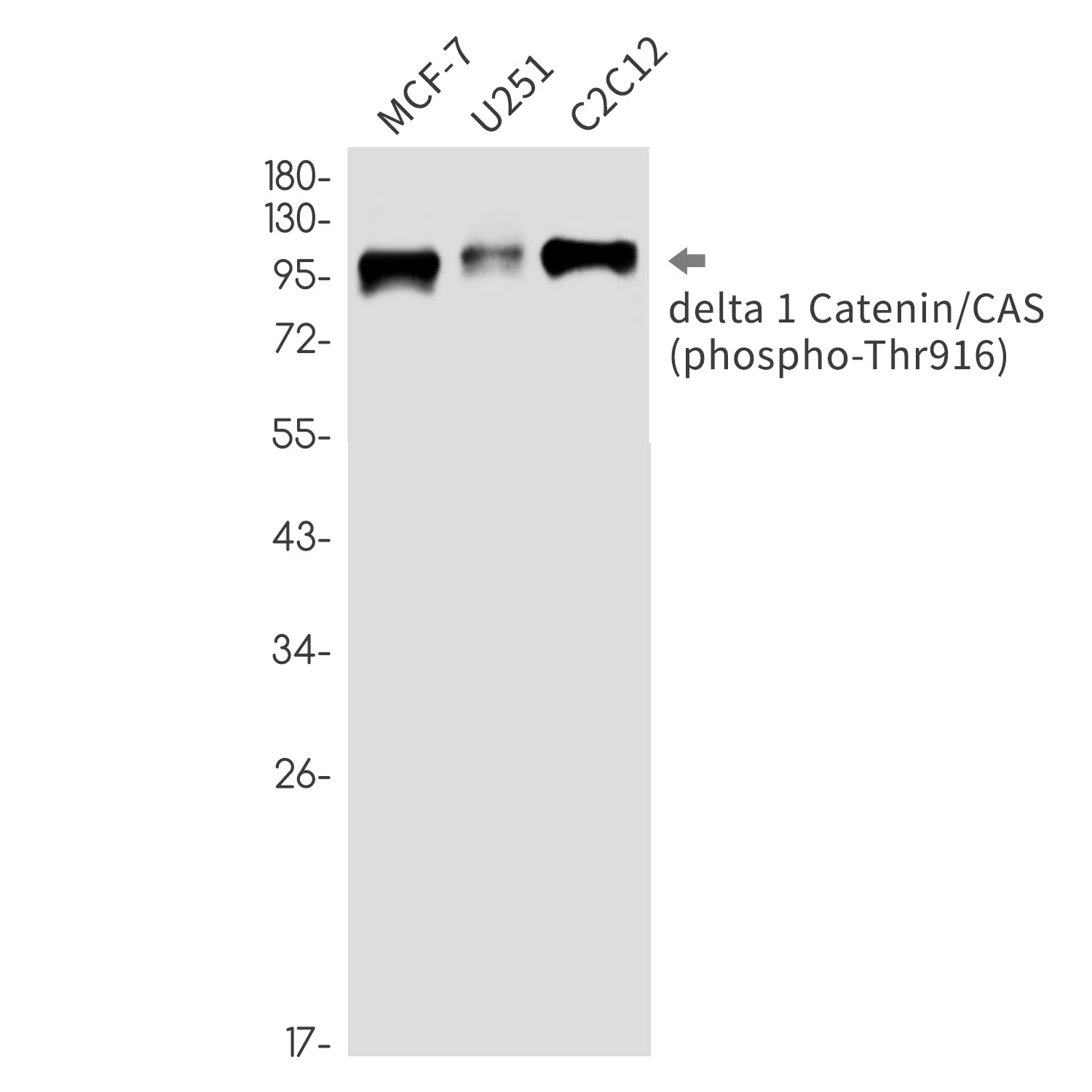 Phospho-delta 1 Catenin (Thr916) Rabbit Monoclonal Antibody - Size: 50µl