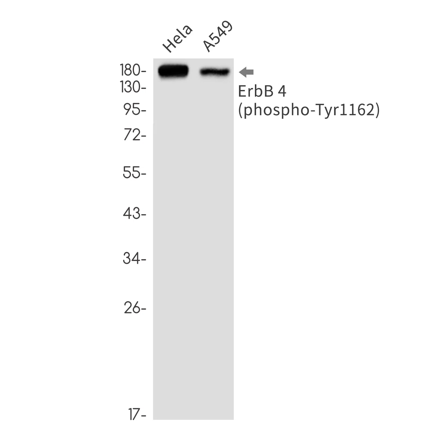 Phospho-ErbB 4 (Tyr1162) Rabbit Monoclonal Antibody - Size: 100µl