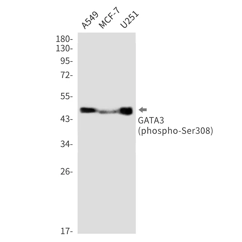 Phospho-GATA3 (Ser308) Rabbit Monoclonal Antibody - Size: 100µl
