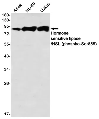 Phospho-Hormone Sensitive Lipase (Ser855) Rabbit Monoclonal Antibody - S