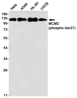 Phospho-MCM2 (Ser27) Rabbit Monoclonal Antibody - Size: 100µl
