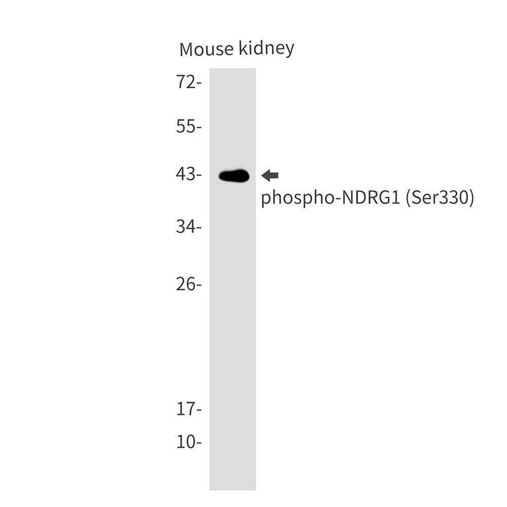 Phospho-NDRG1 (Ser330) Rabbit Monoclonal Antibody - Size: 50µl